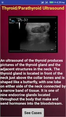 Emergency Ultrasound Cases android App screenshot 0